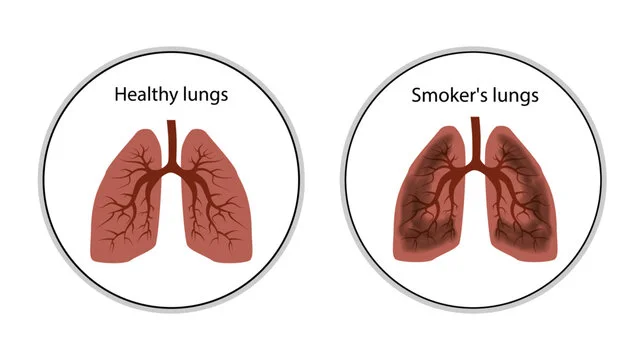 Smoking Impacts